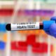 HbA1c Test Price