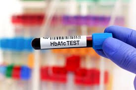 HbA1c Test Price