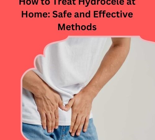 How to Treat Hydrocele at Home