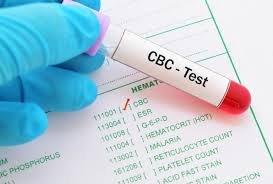 CBC Blood Test in Lahore Accurate Health Screening for Complete Blood Analysis